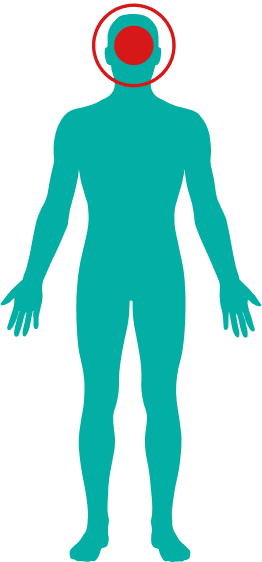 Clínica UDR. Unidad del Dolor y Rehabilitación - Cefalea/Migraña - Pasted 20260612 073823 1